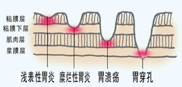 病变